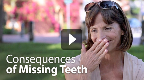 Dental Implant Video - Consequences of Missing Teeth